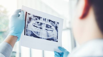 Dentist holding up x-ray of mouth. 